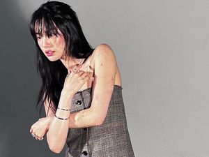 Nana Bagikan Video Hapus Tato di Seluruh Tubuh