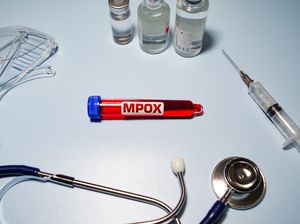 Irlandia Catat Ratusan Kasus Mpox, Kebanyakan Tertular Lewat Aktivitas Seks Irlandia Catat Ratusan Kasus Mpox, Kebanyakan Tertular Lewat Aktivitas Seks