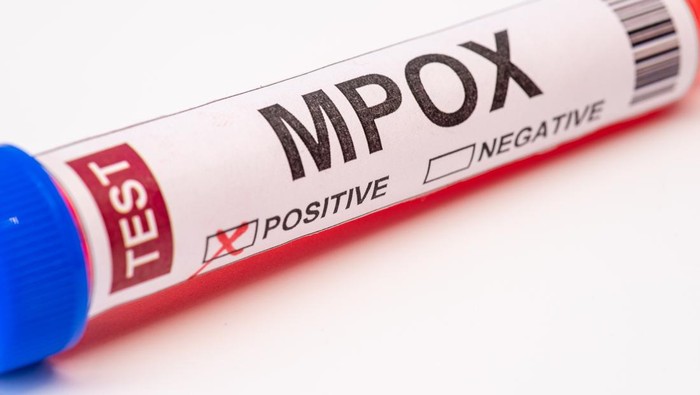 Blood collection tubes monkeypox （MPOX） test positive results