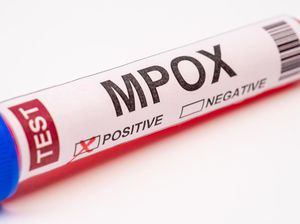 Kasus Pertama Cacar Monyet Mpox Clade I Muncul di AS Kasus Pertama Cacar Monyet Mpox Clade I Muncul di AS