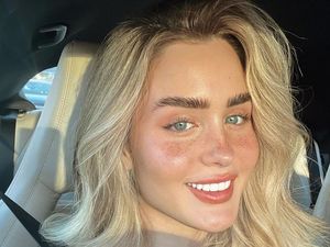 Merasa Jelek, Influencer Ini Habiskan Rp 475 Juta untuk Dapat Wajah Baru Merasa Jelek, Influencer Ini Habiskan Rp 475 Juta untuk Dapat Wajah Baru