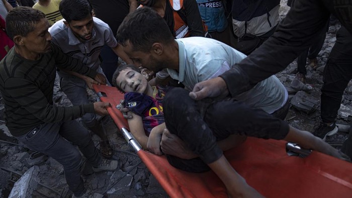 Kisah Pilu di Gaza, Puluhan Ribu Korban Luka Berjuang untuk Hidup