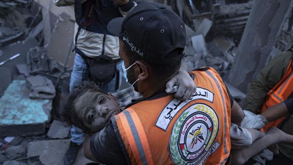 Potret Evakuasi Anak-anak di Gaza yang Terluka Akibat Serangan Israel