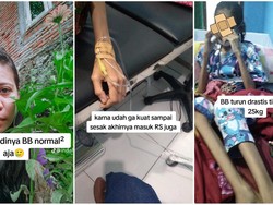Kisah Viral Wanita Idap Asam Lambung Parah Berujung BB Tinggal 25 Kg