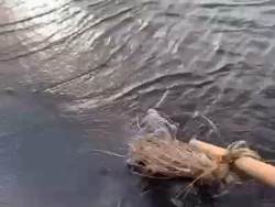 Heboh Potongan Kaki Hasil Amputasi Pasien Diabetes Dibuang ke Pantai