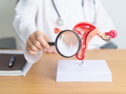 Video: Bisa Periksa Deteksi Dini Kanker di Program Cek Kesehatan Gratis