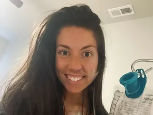 Pura-pura Sakit Kanker, Wanita Ini Tipu 400 Orang untuk Berdonasi