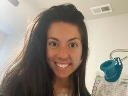 Pura-pura Sakit Kanker, Wanita Ini Tipu 400 Orang untuk Berdonasi