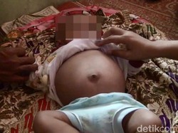 Bayi Hamil hingga Pria Tempelkan Kelamin ke Al-Quran Bikin Geger Sumbar