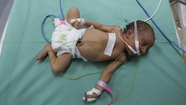Blokade Listrik Israel Ancam Nyawa Bayi Gaza yang Lahir Prematur A premature Palestinian baby lies in an incubator at the maternity ward of Shifa Hospital, which according to health officials is about to shut down as it runs out of fuel and power, as the conflict between Israel and the Palestinian Islamist group Hamas continues, in Gaza City October 22, 2023. REUTERS/Mohammed Al-Masri