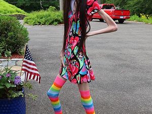 Youtuber Anoreksia Bikin Warganet Khawatir hingga Hubungi 911