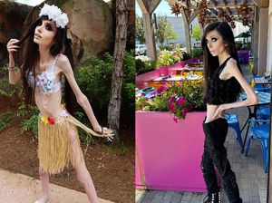 Bertubuh Sangat Kurus, Selebgram Ini Bikin Khawatir Netizen