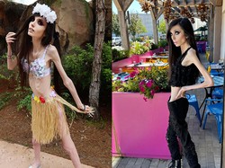 Bertubuh Sangat Kurus, Selebgram Ini Bikin Khawatir Netizen