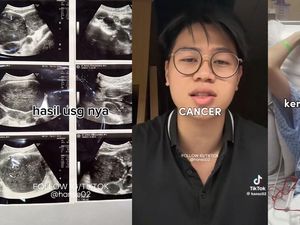 Viral Pria Bandung Berjuang Lawan Kanker Limfoma, Keluhkan Sering Beser Viral Pria Bandung Berjuang Lawan Kanker Limfoma, Keluhkan Sering Beser