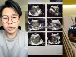 Viral Pria Umur 21 Kena Kanker Getah Bening, Gejala Awalnya Gampang Capek