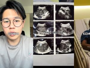 Viral Pria Umur 21 Kena Kanker Getah Bening, Gejala Awalnya Gampang Capek Viral Pria Umur 21 Kena Kanker Getah Bening, Gejala Awalnya Gampang Capek