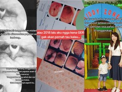 Viral Wanita Berjuang Lawan GERD 3 Tahun, Sempat Dikira Cuma Radang Tenggorokan