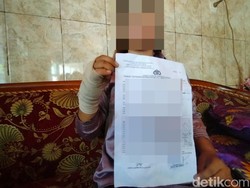 AH yang Dianiaya gegara Tolak Aborsi Minta Perlindungan LPSK