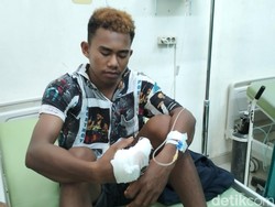 Warga Pulau Rinca yang Digigit Komodo Dapat 16 Jahitan