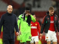 MU Digilas Man City, Ten Hag: Menyakitkan!