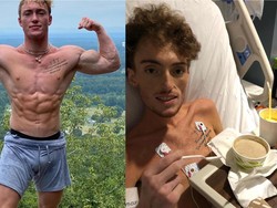 Perjuangan Influencer Kebugaran Obati Kanker Limfoma yang Nyaris Renggut Nyawa