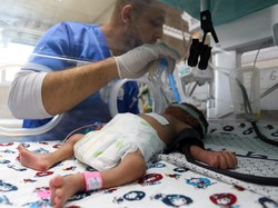 Parahnya Kondisi di Gaza, Dokter-dokter Kelaparan karena Tak Ada Makanan