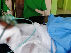 Kondisi Lansia Bakar Diri Pakai Pertalite di Kuburan, Luka 100 Persen