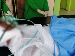 Kondisi Lansia Bakar Diri Pakai Pertalite di Kuburan, Luka 100 Persen Kondisi Lansia Bakar Diri Pakai Pertalite di Kuburan, Luka 100 Persen