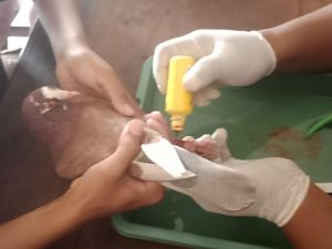 Cincin di Burung Tak Bisa Lepas hingga Bengkak, 2 Pria Klaten Sambat ke Damkar Cincin di Burung Tak Bisa Lepas hingga Bengkak, 2 Pria Klaten Sambat ke Damkar