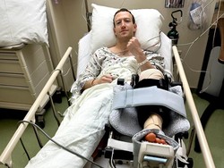 Mark Zuckerberg Cedera ACL saat Latihan MMA, Berujung Operasi