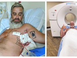 Cerita Pria Kena Kanker Payudara Stadium 4, Sempat Mengira Lelaki Tak Bisa Kena