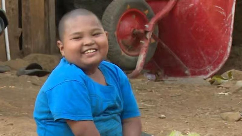 Mari Bantu Rizky, Anak Pembuat Kusen dengan Kaki-Tangan Tak Sempurna