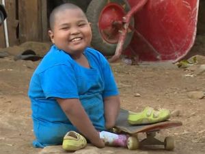 Mari Bantu Rizky, Anak Pembuat Kusen dengan Kaki-Tangan Tak Sempurna