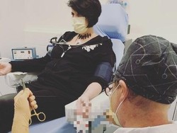 Cerita Wanita Pemilik Rekor Implan Chip-Magnet ke Tubuh Terbanyak di Dunia