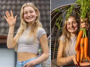 Terlalu Sering Makan Wortel, Kulit Wanita Ini Berubah Jadi Oranye