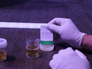 Tes Urine untuk Apa? Kenali 6 Fungsi, Jenis, dan Prosedurnya