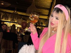 Di-bully karena Warna Kulit, Wanita Ini Jadi Kecanduan Oplas Sejak 11 Tahun Di-bully karena Warna Kulit, Wanita Ini Jadi Kecanduan Oplas Sejak 11 Tahun