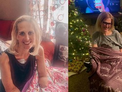 Kronologi Ibu di AS yang Kaki-Tangannya Diamputasi Usai Idap Flu, Begini Awalnya