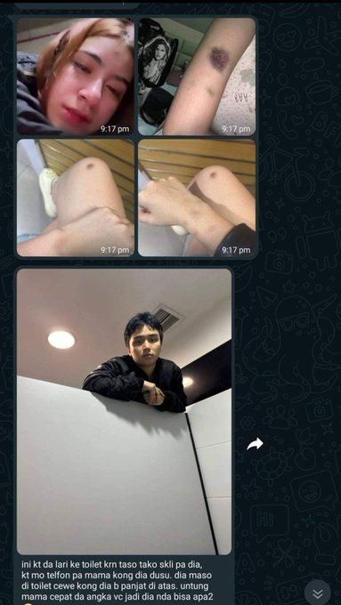 Beredar foto diduga kekasih Leon Dozan alami kekerasan.