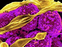 Kelangkaan Antibiotika Meningkat di Seluruh Dunia