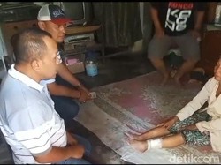 Dua Balita dan Nenek di Jember Jadi Korban Serangan Monyet