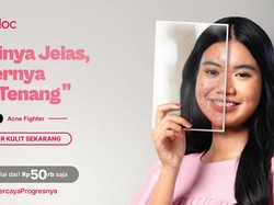 Bye Jerawat, Ini Jurus Perawatan Tepat buat Punya Kulit Sehat