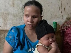 Mari Bantu Yanti, Ibu Tunanetra di Bone yang Jadi Pengupas Bawang