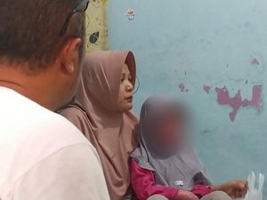Perjuangan Evi Besarkan Anaknya yang Alami Kelainan Kulit Perjuangan Evi Besarkan Anaknya yang Alami Kelainan Kulit