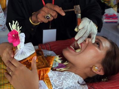Melihat Lebih Dekat Ritual Potong Gigi Massal di Bali