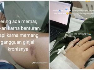 Kronologi Wanita Medan Idap Gagal Ginjal, Sempat 2 Hari Cegukan Tak Berhenti Kronologi Wanita Medan Idap Gagal Ginjal, Sempat 2 Hari Cegukan Tak Berhenti