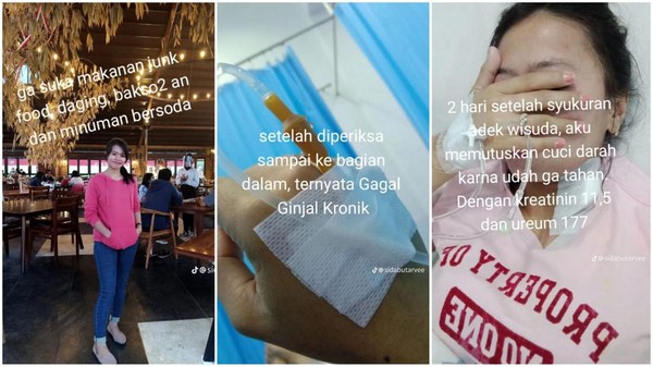 Wanita idap gagal ginjal kronis