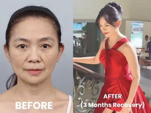 Dulu Viral Karena Awet Muda, Ini Penampilan Baru Puspa Dewi Setelah Oplas Dulu Viral Karena Awet Muda, Ini Penampilan Baru Puspa Dewi Setelah Oplas