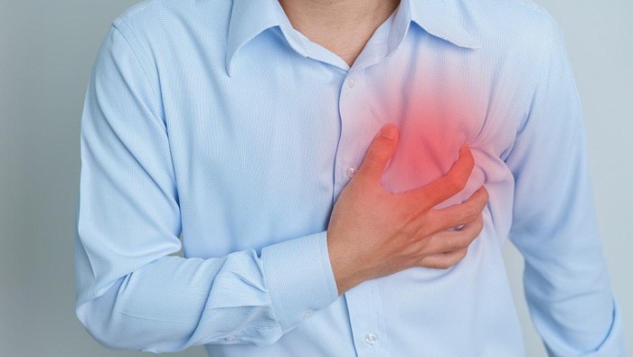 Ilustrasi aterosklerosis Aterosklerosis merupakan penyempitan pembuluh darah arteri yang sanggup menyebabkan terjadinya serangan jantung sampai stroke.