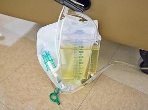 Apa Itu Kateter Urine? Ketahui Jenis dan Kondisi Medis Yang Memerlukannya Apa Itu Kateter Urine? Ketahui Jenis dan Kondisi Medis Yang Memerlukannya